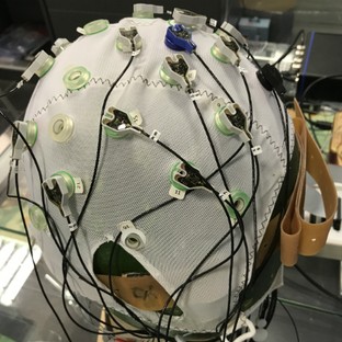 Agyi defibrillátor: megállíthatja az epilepsziás rohamokat