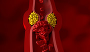 To ci "podbija" cholesterol. Czynniki, które podwyższają cholesterol