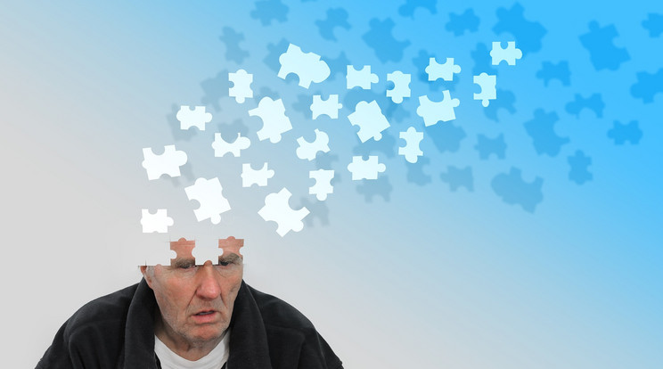 30 millió ember szenvedhet Alzheimer-kórban/Illusztráció: Pixabay