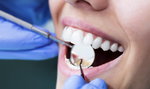 NFZ przestanie płacić za dentystów? 