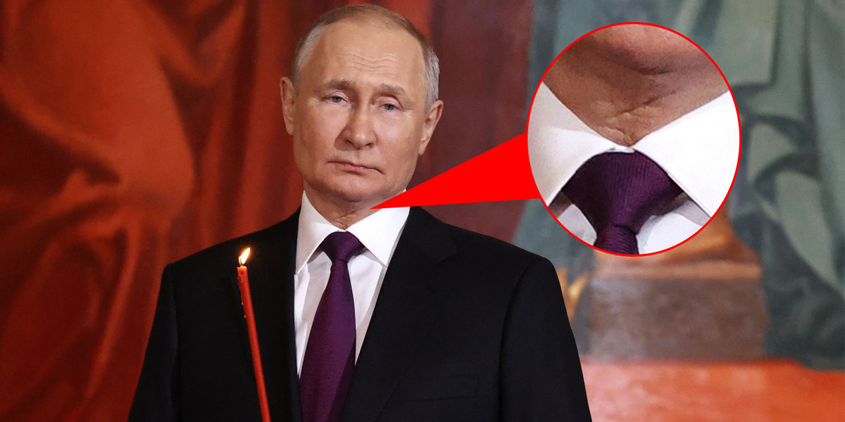 Władimir Putin ma raka? Na jego szyi widać charakterystyczny znak.
