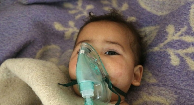 A child receives treatment following a suspected chemical attack in Khan Sheikhun, a rebel-held town in Syria's the northwestern Idlib province, on April 4, 2017