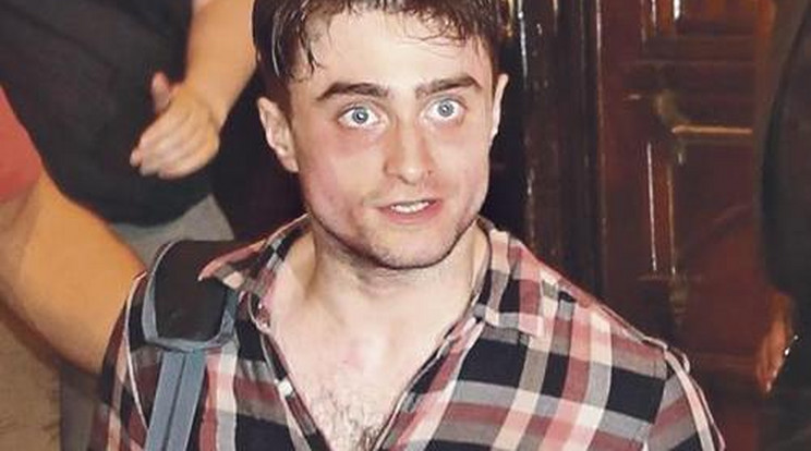 Radcliffe teljesen kikészült