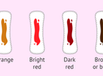 What every colour of your menstrual blood says about your health
