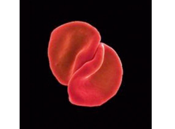 Peter Gabriel ponad coverami