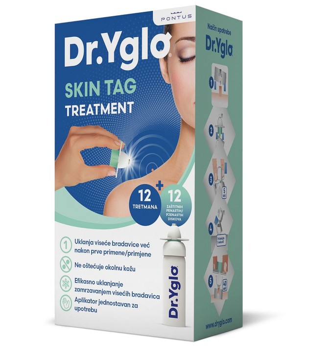 Dr Yglo Skin Tag Treatment