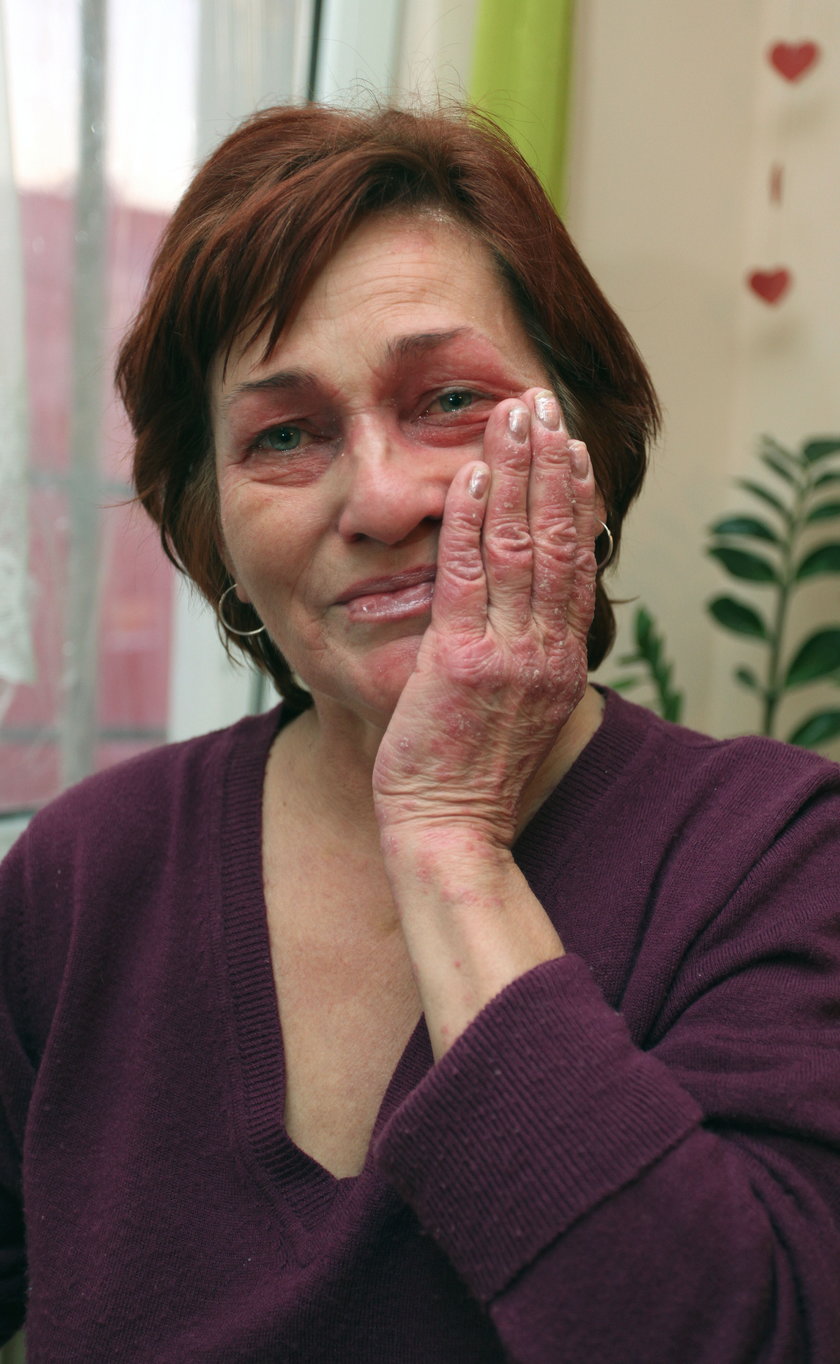 Maria Gutowska (54 l.) leczy się od lat