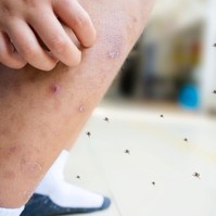 Okozhat allergiát a szúnyogcsípés gyerekeknél? Erre figyelmeztet a gyermekgyógyász