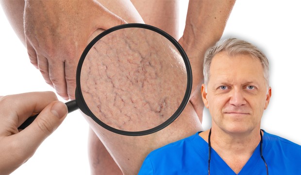 Ljudi očekuju da prvo vide velike plave vene, međutim, često sve počinje mnogo diskretnije, objašnjava vaskularni hirurg dr Dario Jocić