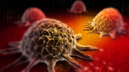 Co robią onkolodzy, żeby uniknąć raka? Pięć banalnych rad, które musisz wprowadzić TERAZ