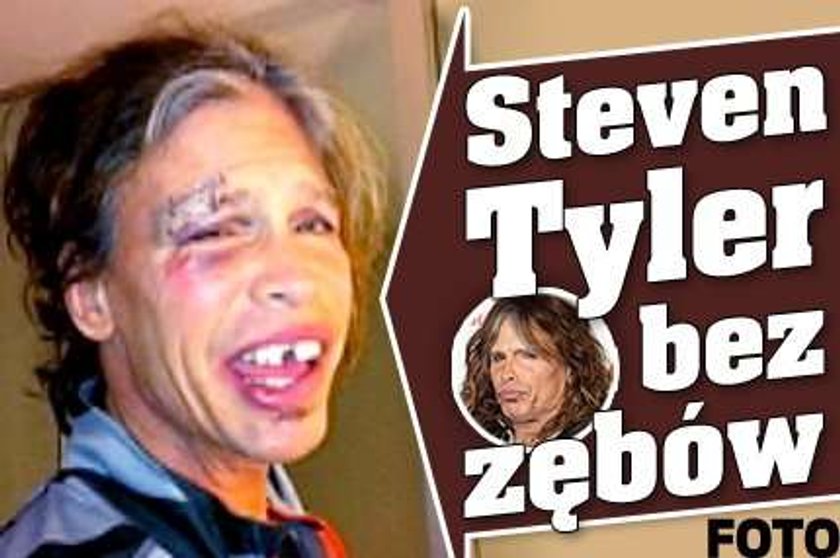 Steven Tyler bez zębów. Foto