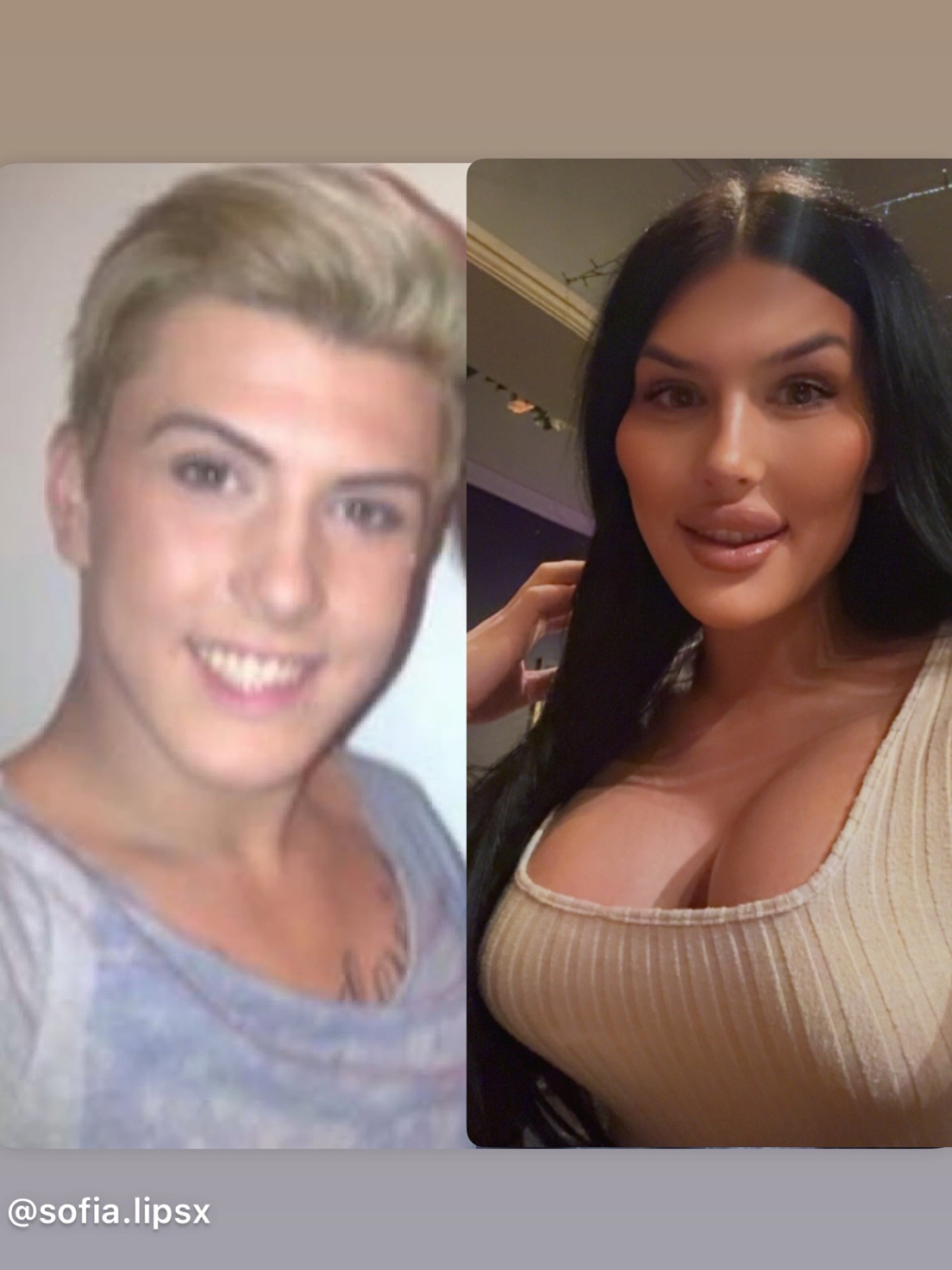 Sofia Lips má podľa vlastných slov najväčšie pery v Spojenom kráľovstve.
