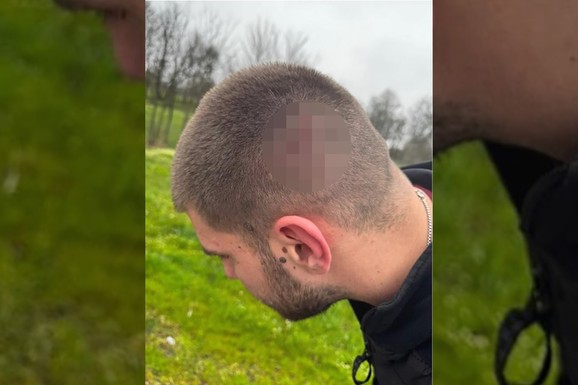 "IMALI SU PALICE, PRSKALI ME SUZAVCEM" Oglasio se aktivista SNS Vukašin Đorđević koji je pretučen u Smederevskoj Palanci