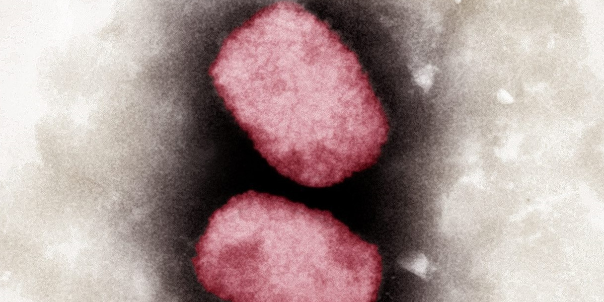 Wirus małpiej ospy. Zdjęcie z 2001 r., przekazane w maju 2022 przez Instytut Roberta Kocha (RKI) w Niemczech, federalną placówkę badawczą, odpowiedzialną za zapobieganie chorobom oraz ich kontrolę. 