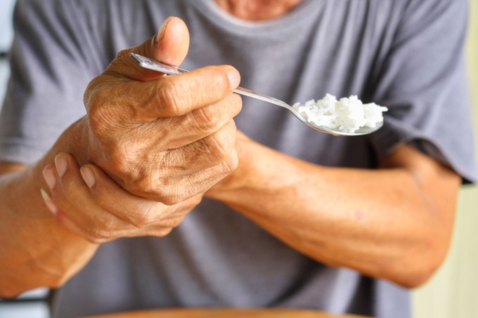 Ezektől a tényezőktől is függ, hogy kinél alakul ki Parkinson-kór