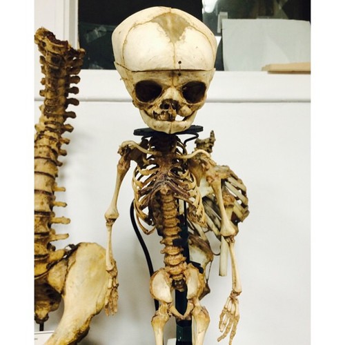 Ekspt z Mütter Museum w Filadelfii