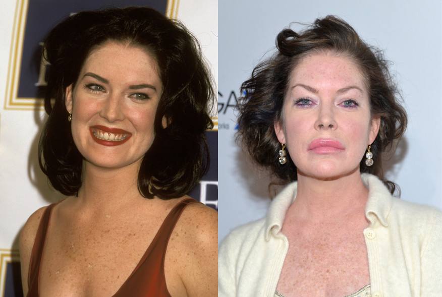 Lara Flynn Boyle w 1992 r. i obecnie