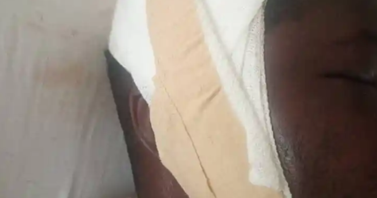 Man brutally beaten over alleged disappearance of Okada rider's penis at Senya Bereku - Vimarsana News