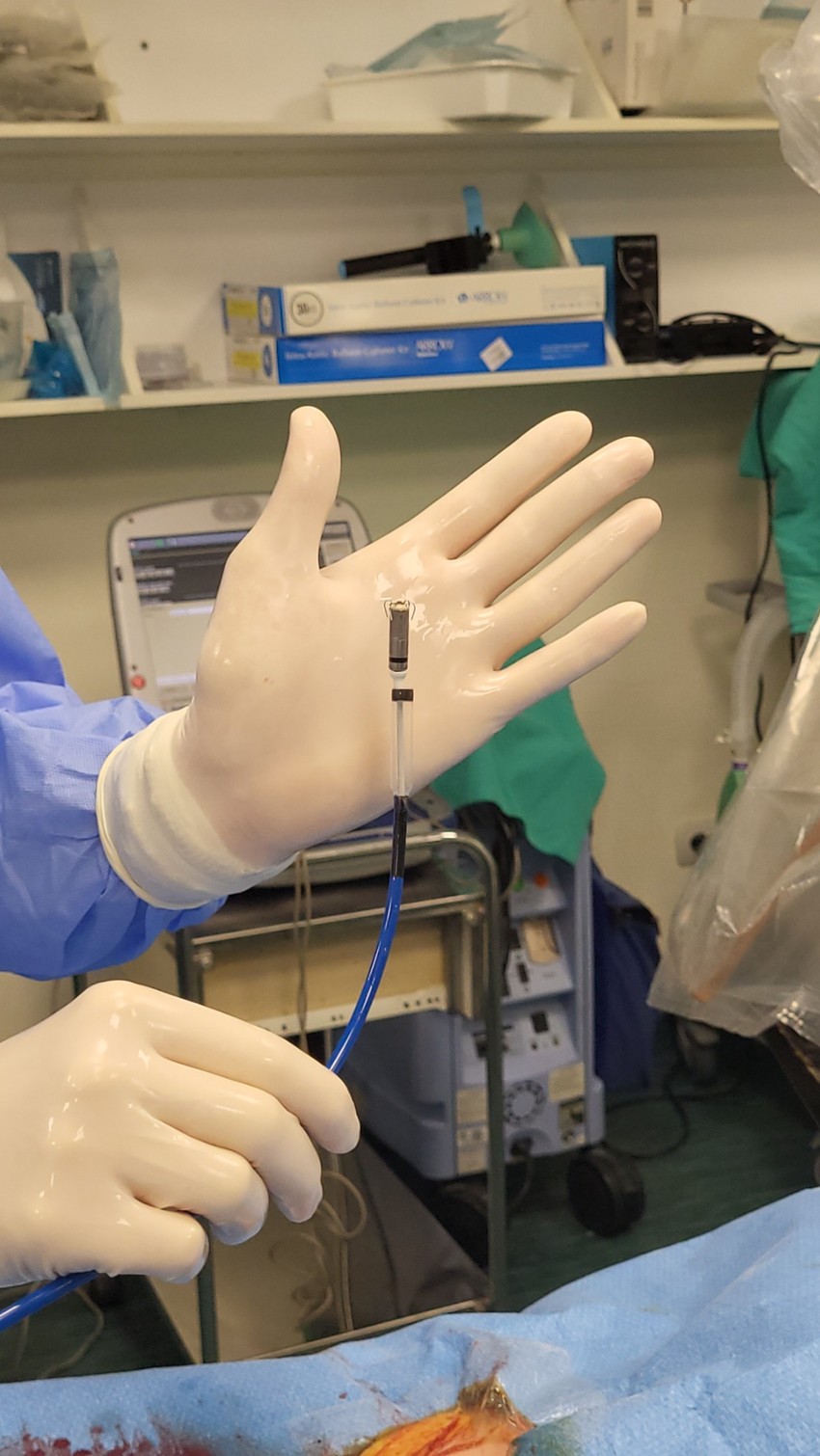 Najmanjeg pejsmejkera na svetu teži manje od dva grama i ima zapreminu od svega 0,8 kubika