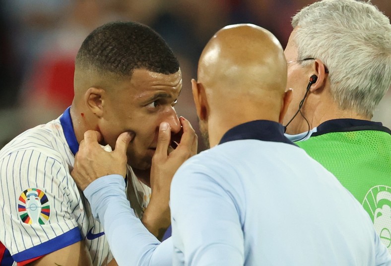 Mbappe miał swój udział w zdobyciu jedynego gola w meczu z Austrią. W 39. minucie po jego zagraniu w kierunku Antoine'a Griezmanna Maximilian Woeber skierował piłkę głową do własnej bramki. Na początku drugiej połowy Mbappe mógł podwyższyć na 2:0, ale nie