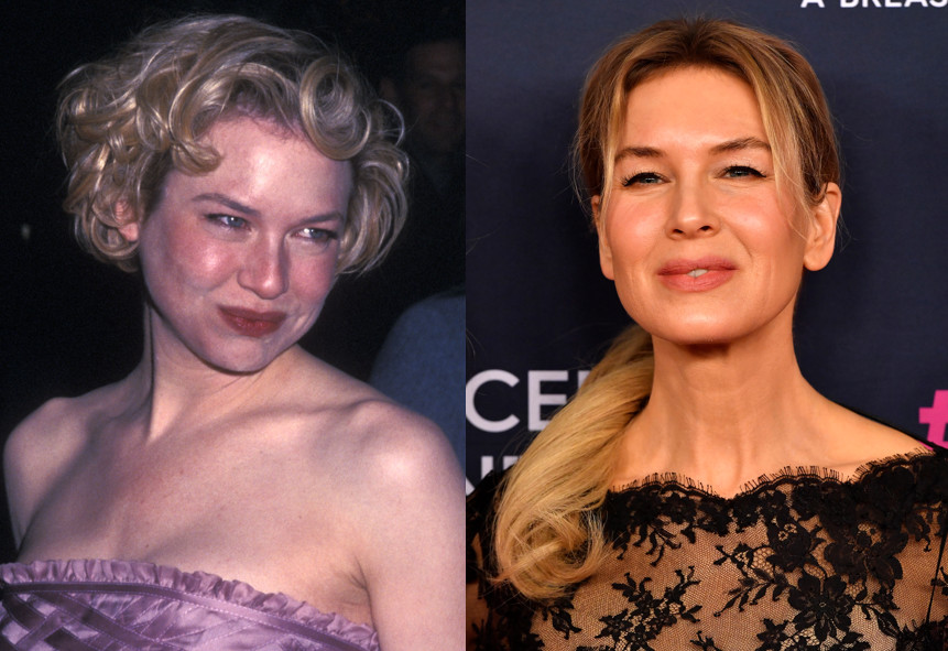Renée Zellweger w 1999 r. i obecnie