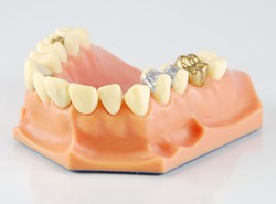 Masz sztuczną szczękę? Zarób na niej kokosy