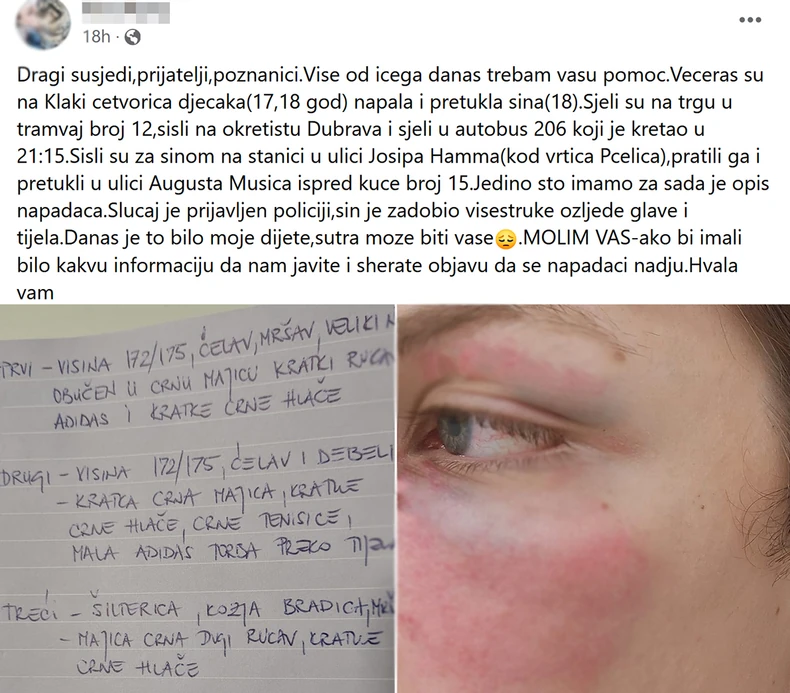 Potresni apel majke pretučenog mladića u Zagrebu