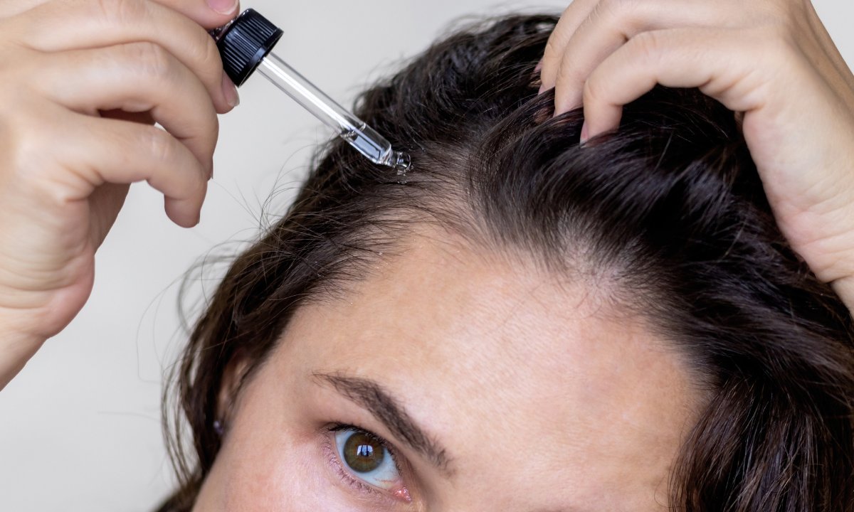 To serum na wypadanie włosów zatrzymuje choćby łysienie! Rosną po nim jak na drożdżach
