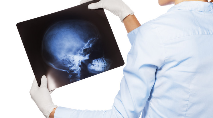 Betört a férfi koponyája, miután támadója ellökte őt / Illusztráció: Shutterstock