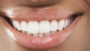 Woman with white teeth