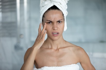Pattanás, rosacea, hajhullás - ezeket bőratka is okozhatja
