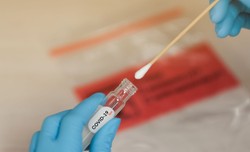 Ekspertka: Czas działa na korzyść wirusa