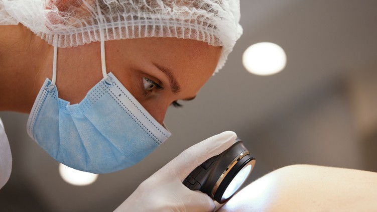 bőrrák, bőrdaganat, melanoma, fényvédelem