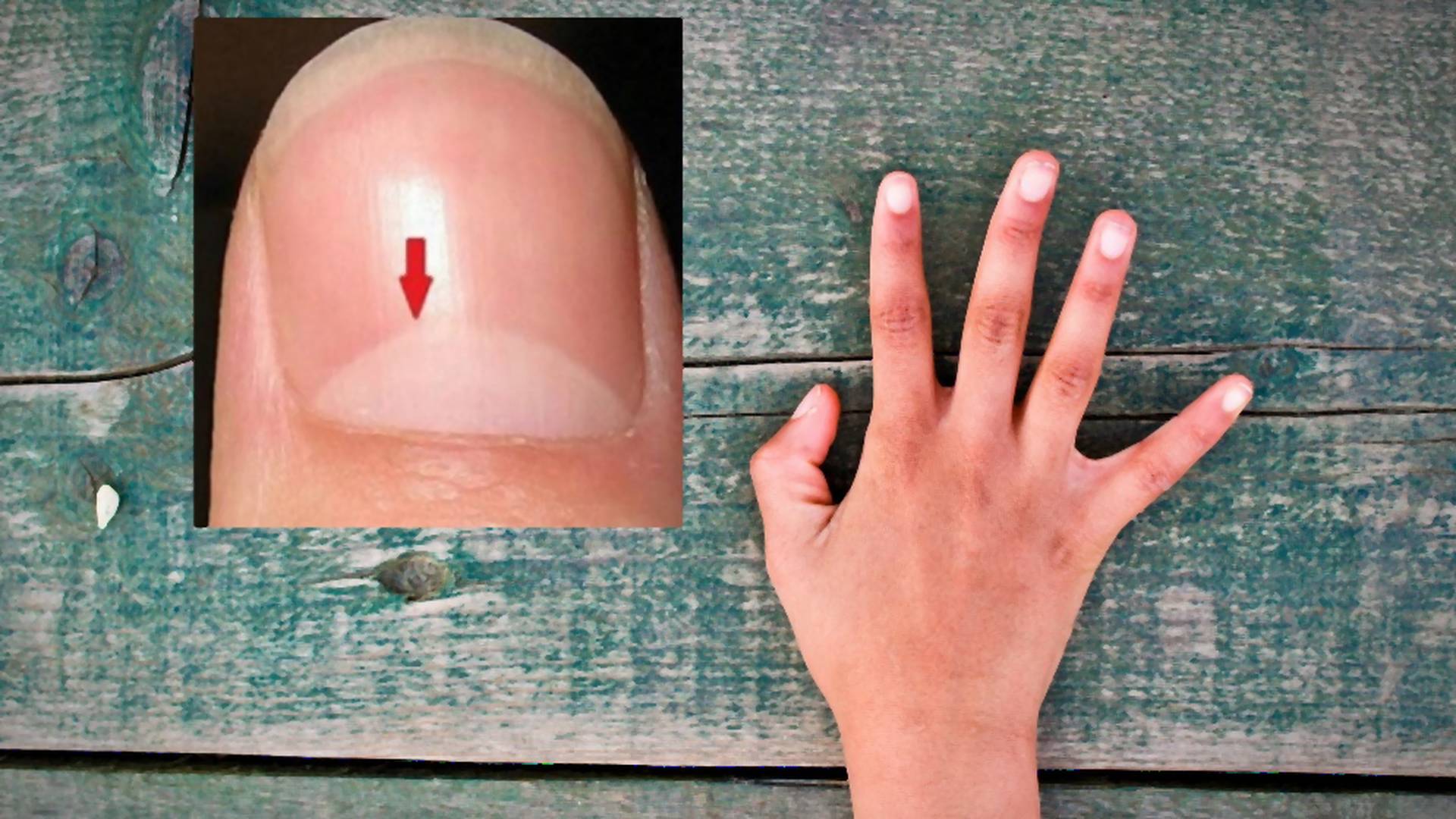 Znate li šta znači beli polukrug na vašem noktu?