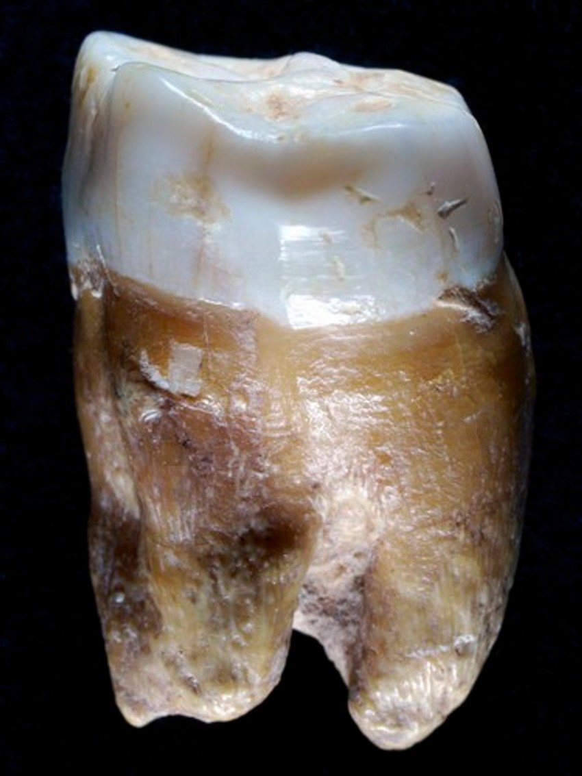 Zub neandertalca