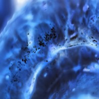 Már kialakulás előtt diagnosztizálható a rák kockázata ezzel a módszerrel