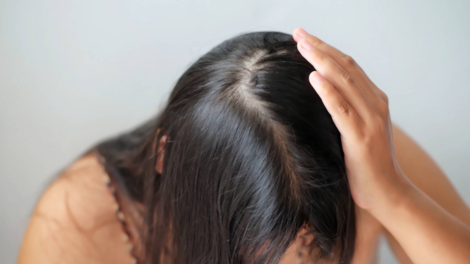 Pięć przyczyn wypadania włosów, które dotykają młode kobiety. Wśród nich między innymi stres