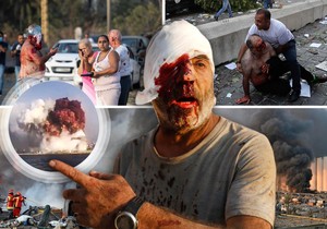 bejrut eksplozija kombo RAS Tanjug AP, epa wael hamzeh