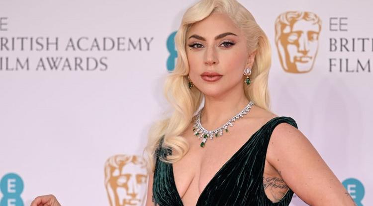 Lady Gaga ragyogó arcbőrének titka. Fotó: Getty Images