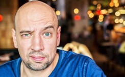 Kraj o największej liczbie łysiejących? Zdziwisz się