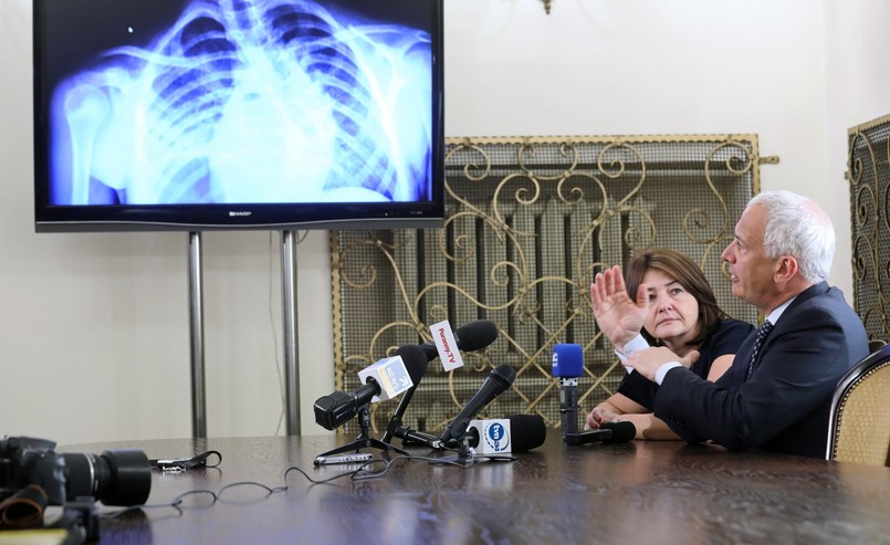 Dr Darryl Antonacci z Institute for Spine and Scoliosis (New Jersey) oraz rektor Uniwersyteckiego Dziecięcego Szpitala Klinicznego oraz prodziekan Wydziału Lekarskiego UM w Białymstoku prof. dr hab. n. med. Anna Wasilewska