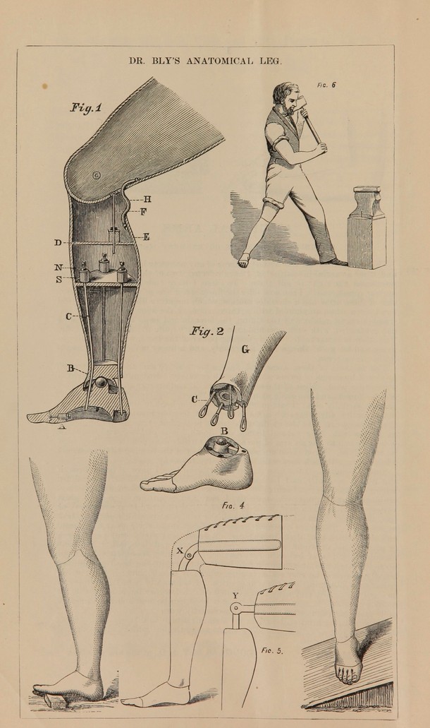 Rycina z publikacji „Niezwykłe wynalazki Douglasa Bly ok. 1876 r