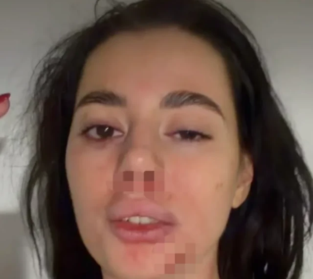 Bivša zadrugarka podelila jezive fotografije nakon što je pretučena