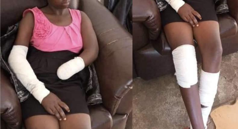 He ordered me to undress & I refused - Student, 16 narrates how rapist cut off her hand