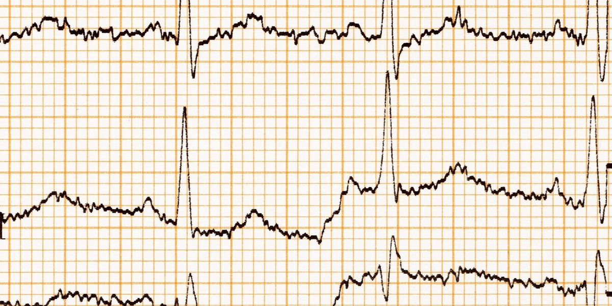 Pacjenci zostaną wyposażeni w aparaty EKG