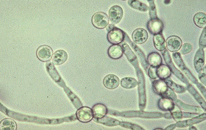 Candida-fertőzés, mint figyelmeztető jel