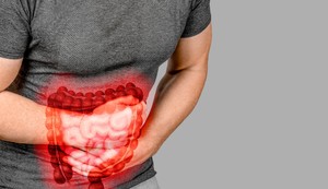 Rak rektuma u porastu među milenijalcima