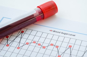 3-as típusú cukorbetegség tünetei: előfordul, hogy tévesen a 2-esbe sorolják