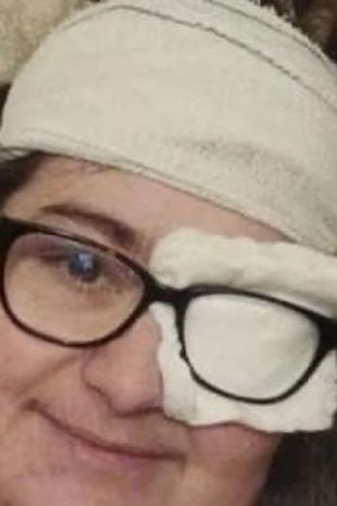 Žena by bez operácie do dvoch mesiacov zomrela
