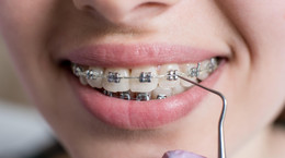 Wady zgryzu, które skoryguje aparat ortodontyczny